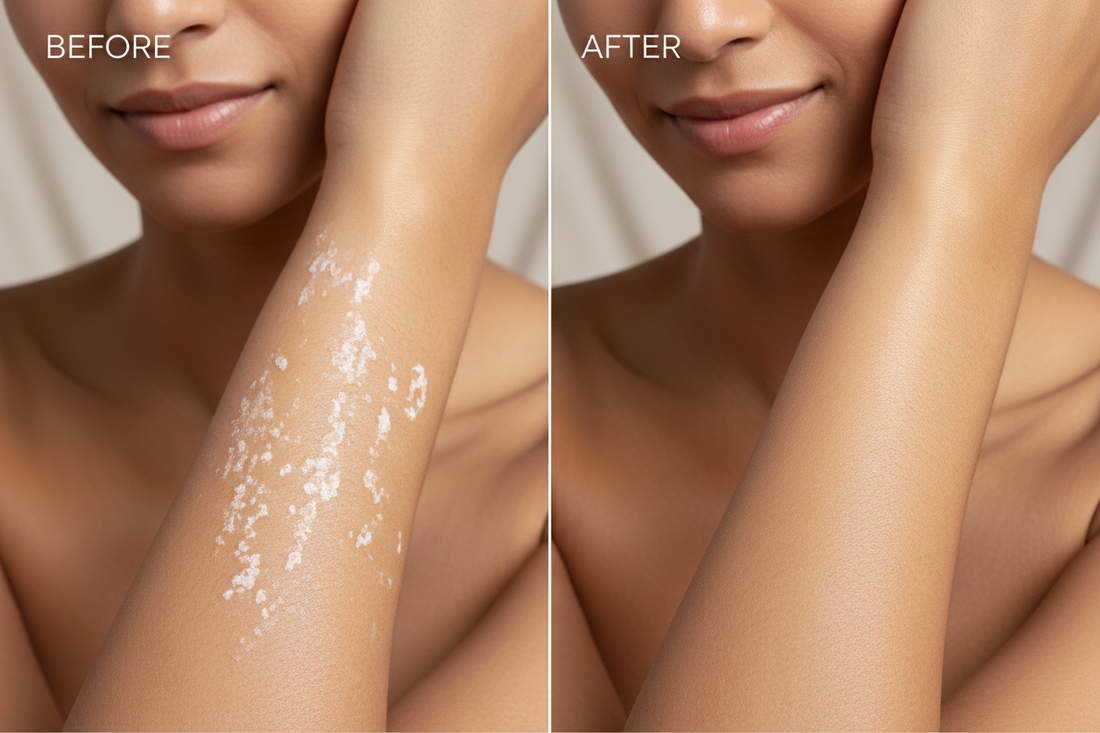 Photo BEFORE/AFTER Hydratant Corps